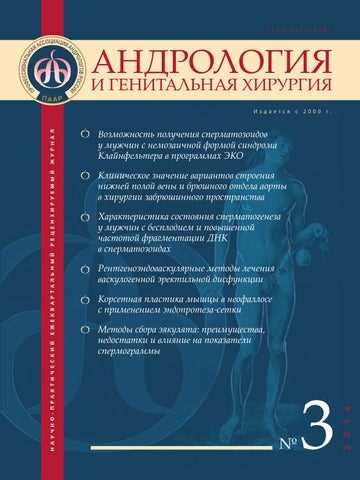 «Пакито» на испанском: происхождение и значение этого слова