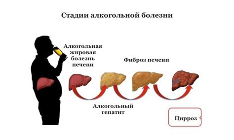 Алкогольное поражение печени: механизмы возникновения и связь с эхогенностью