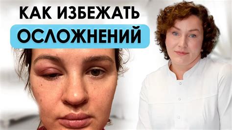 Аллергическая реакция: опасности и профилактика