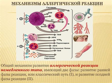 Аллергические реакции и их влияние на лицо