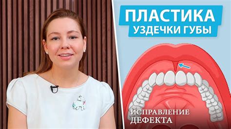 Альтернативные методы коррекции прикуса верхней губы: пластика и имплантация