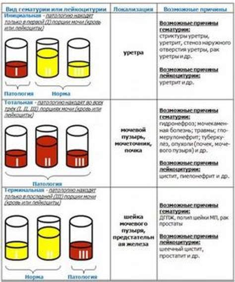 Анализ снов о аромате мочи и его смыслы в толковых сновидениях