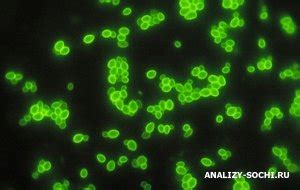 Анализ Candida albicans: значение и основные аспекты