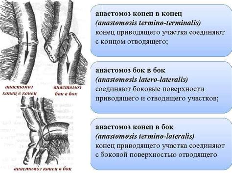 Анастомоз на примере сосудов