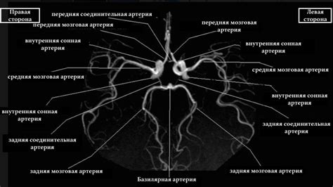 Анатомия Виллизиева круга