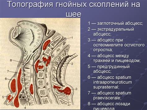 Анатомия и абсцессы