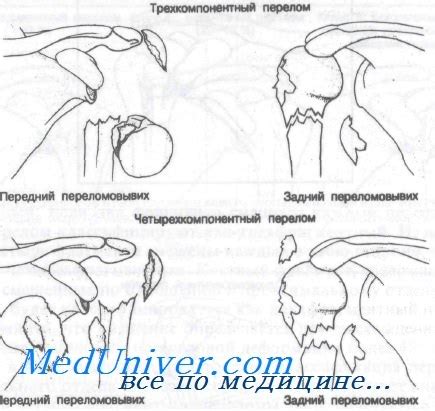 Анатомия проксимального сегмента