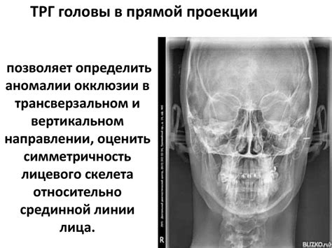 Аномалии ЭОС в вертикальном положении у взрослых