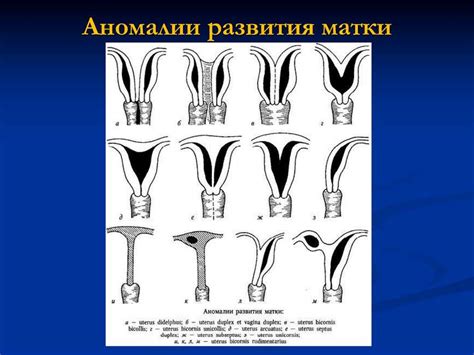 Аномалии матки