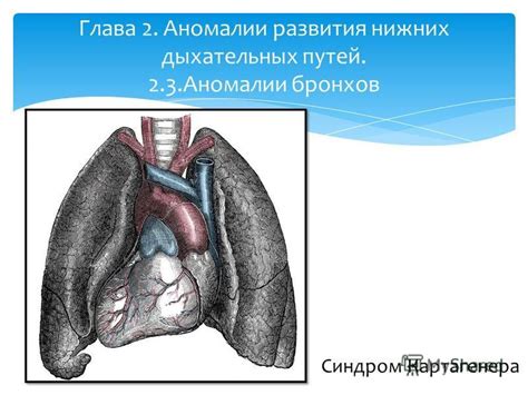 Аномалии развития дыхательных путей