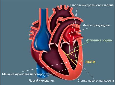 Аномально расположенная хорда левого желудочка: причина и симптомы