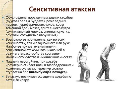 Атаксия: симптомы и причины