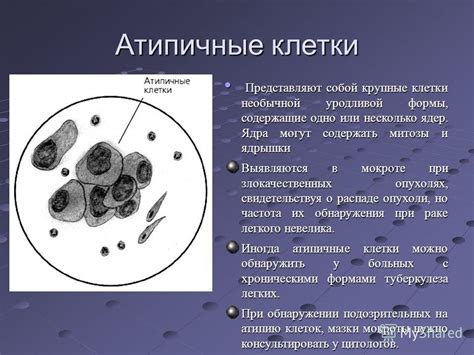 Атипичные клетки: определение и характеристики