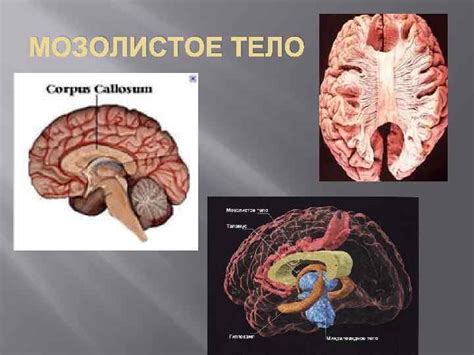 Атрофия мозолистого тела: вредные причины и эффективное лечение