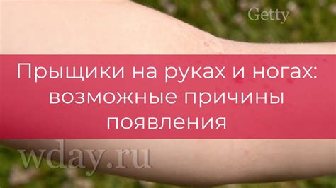 Белые прыщики на руках: причины и способы лечения