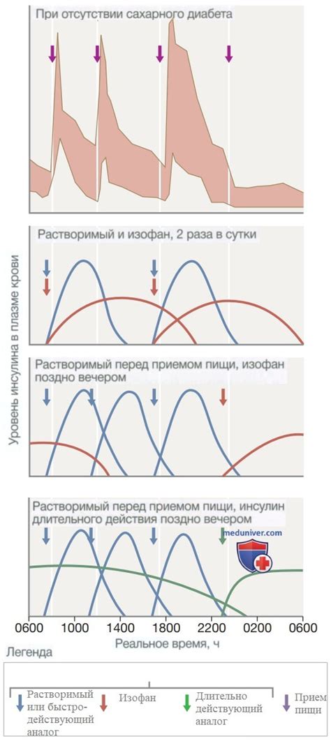 Беспиковый инсулин: новая форма лечения сахарного диабета