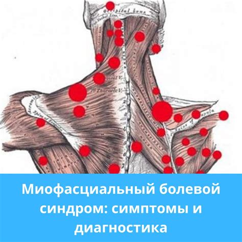 Болевой синдром: основные симптомы и характеристики