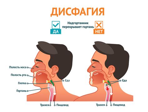 Болезненное глотание и дисфагия