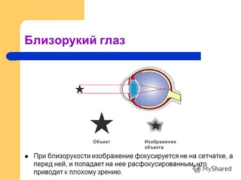 Болезни и условия, приводящие к плохому зрению