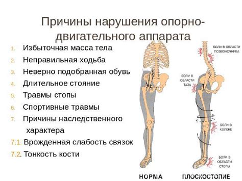 Болезнями опорно-двигательного аппарата