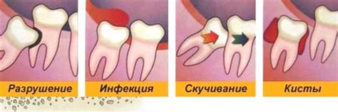 Боли в области десен