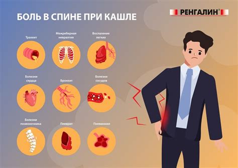 Боли в спине при кашле: диагностика