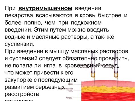 Быстрое действие лекарства при струйном введении