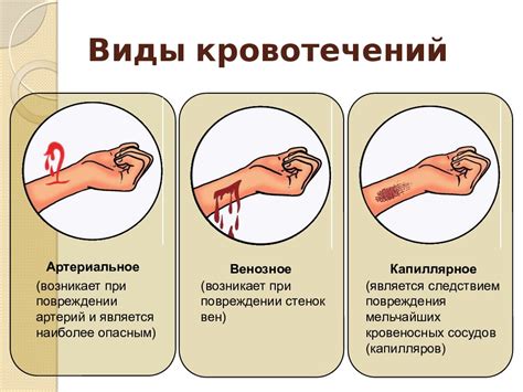 ВМК – опасное кровотечение в гинекологии