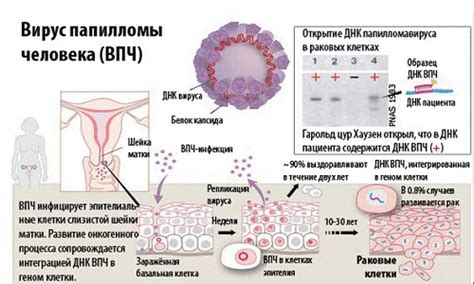 ВПЧ и его значение