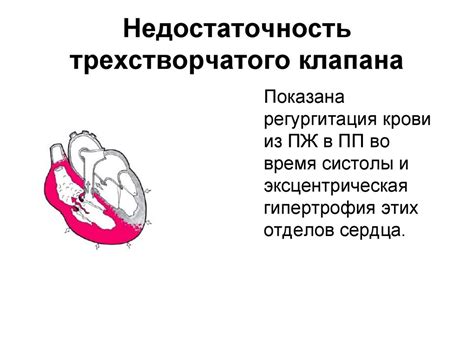 Важность диагностики недостаточности трехстворчатого клапана 1 степени