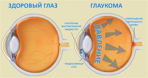 Важность здорового глаза