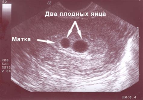 Важность и практическое применение УЗИ при состоянии беременности