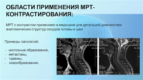 Важность контрастирования для диагностики