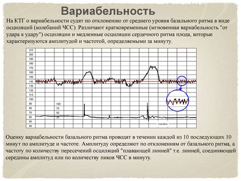 Важность процентов при КТГ