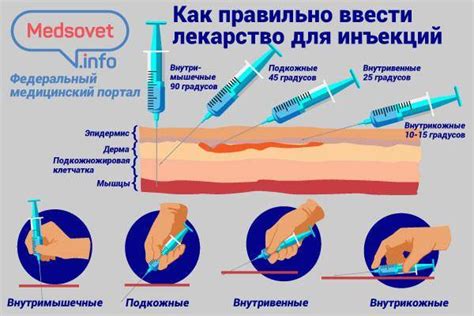 Важные факторы при использовании подкожных уколов