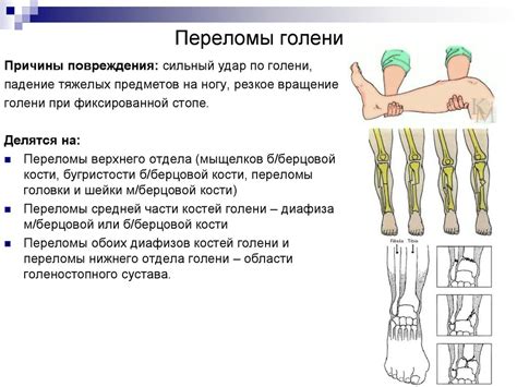 Варианты отека при переломе костей