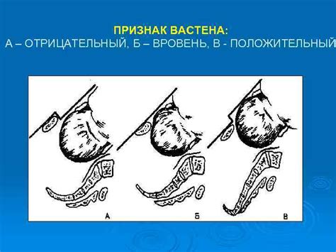 Вастен: его положительный признак и значение