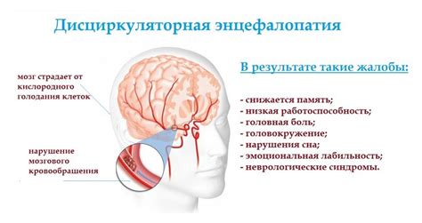 Вегетативные симптомы дисциркуляторной энцефалопатии