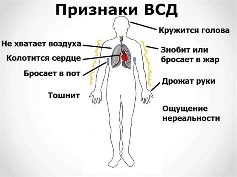 Вегетососудистая дистония