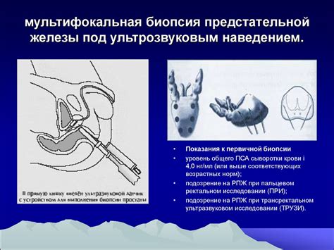 Венепункция как диагностический метод и показания к его проведению