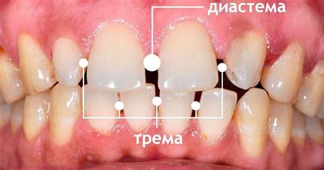 Взаимосвязь между сновидением и физическим состоянием зубов