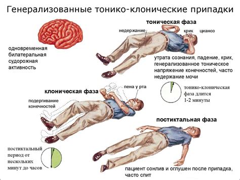 Взаимосвязь обморока с судорогами