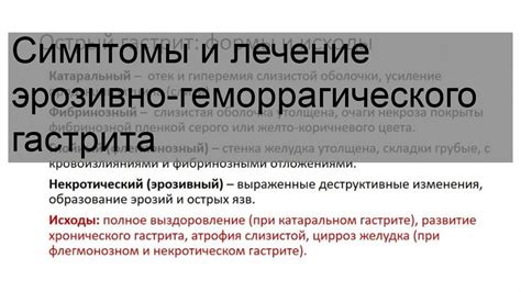 Виды геморрагического ОНМК: подтипы и особенности