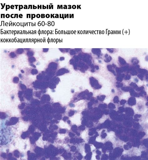 Виды коккобациллярной флоры в человеческом организме