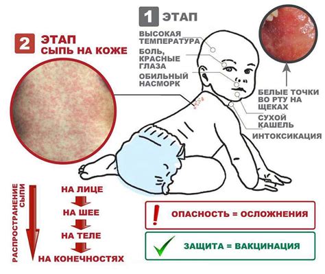 Виды полицефалии у детей