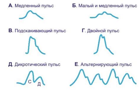 Виды причин учащенного пульса