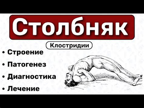 Виды симптомов столбняка