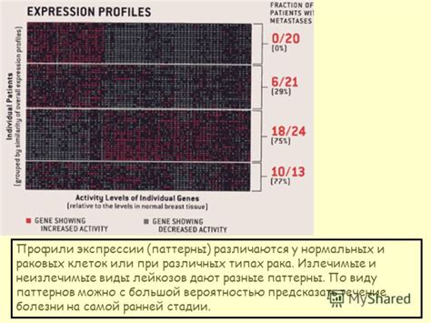 Виды экспрессии