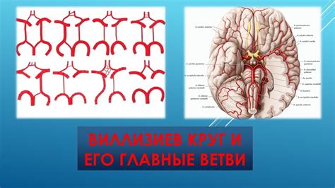 Виллизиев круг и его роль в предотвращении инсульта