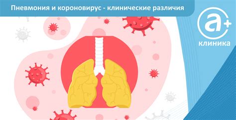 Вирусная пневмония и ковид: сходства и различия